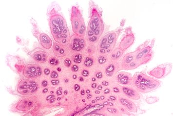 Tak Hanya Perempuan, Laki-Laki Juga Rentan Terinfeksi HPV