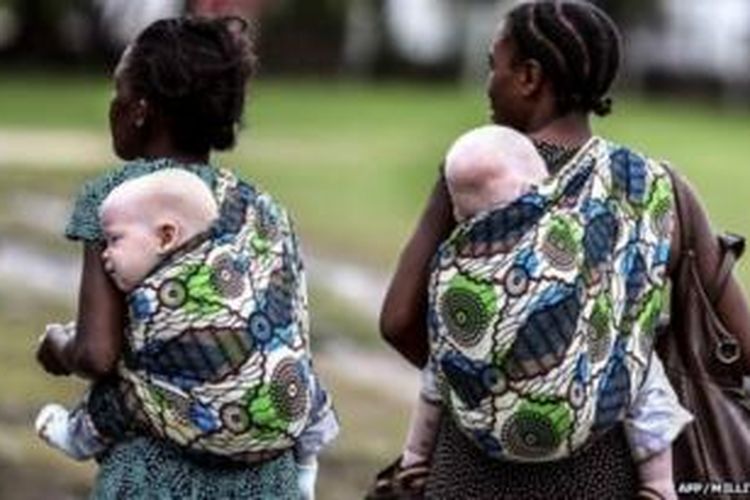 Para dukun tradisional di Tanzania percaya anggota tubuh orang albino berkhasiat untuk ramuan tertentu. Akibatnya, pembunuhan warga albino marak terjadi di negeri Afrika itu.