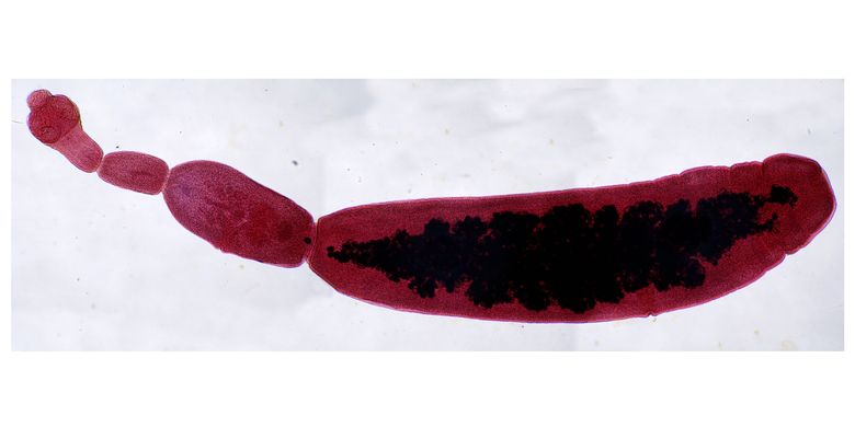 ilustrasi Echinococcus granulosus dilihat dari mikroskop