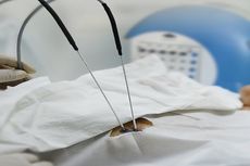 Cryosurgery Ablation: Permainan Suhu Bunuh Kanker Hingga ke Akarnya