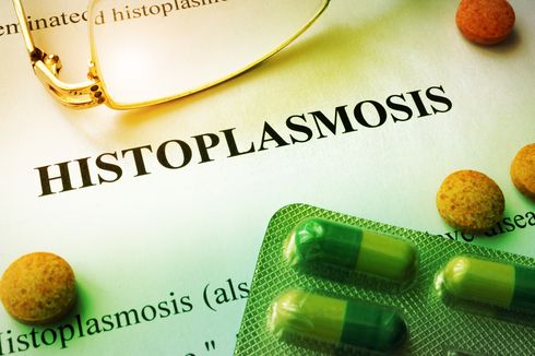 Histoplasmosis