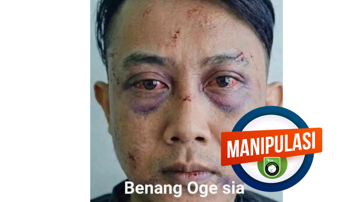 INFOGRAFIK: Foto Taufik Hidayat Babak Belur Merupakan Konten AI