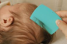 4 Cara Menghilangkan Kerak di Kepala Bayi