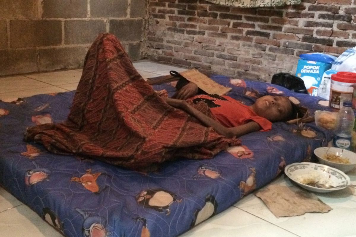 Suaenah (26) yang mengalami gizi buruk dan lumpuh sedang terbaring lemas di kamarnya, Desa Ciangir, Kabupaten Tangerang, Jumat (17/3/2017).