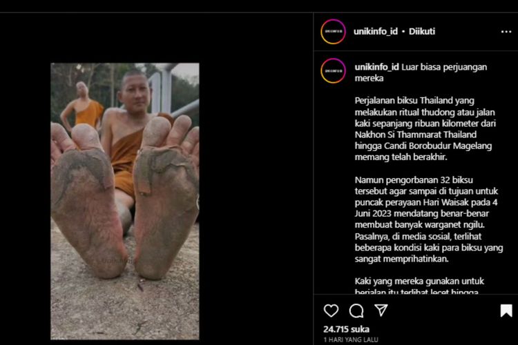 Foto yang memperlihatkan kulit telapak kaki biksu mengelupas ketika berjalan kaki dari Thailand menuju Indonesia untuk menghadiri perayaan Waisak di Candi Borobudur pada Minggu (4/6/2023).