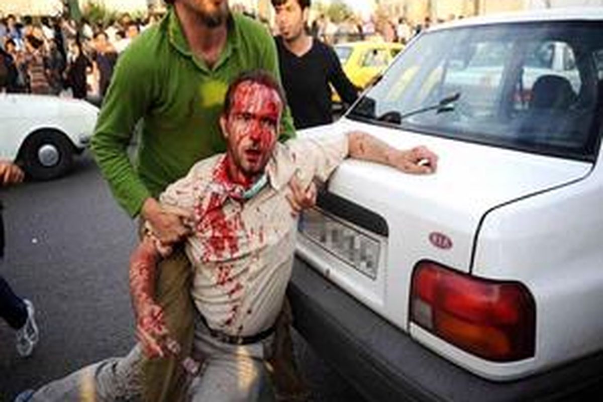 Gambar seorang demonstran yang bersimbah darah yang beredar hingga ke Barat melalui situs Twitter.