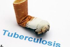 488 Penderita Tuberkolusis di Jatim Kebal Obat