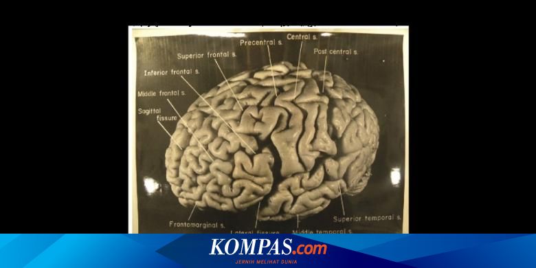Menguak 5 Misteri Otak Halaman All Kompas Com