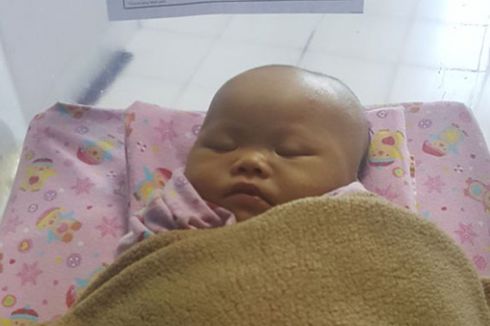 Bayi Tanpa Anus di Batam Akhirnya Dapat Bantuan untuk Operasi