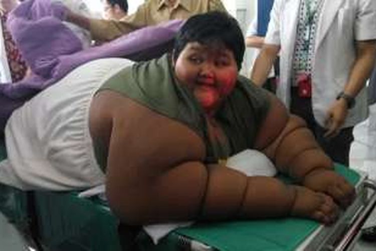 Arya Permana (10) penderita severe obesity ditangani 13 dokter spesialis RSHS. Berat badan normal Arya kurang dari 50 kg, namun saat ini beratnya mencapai 189,5 kg. 