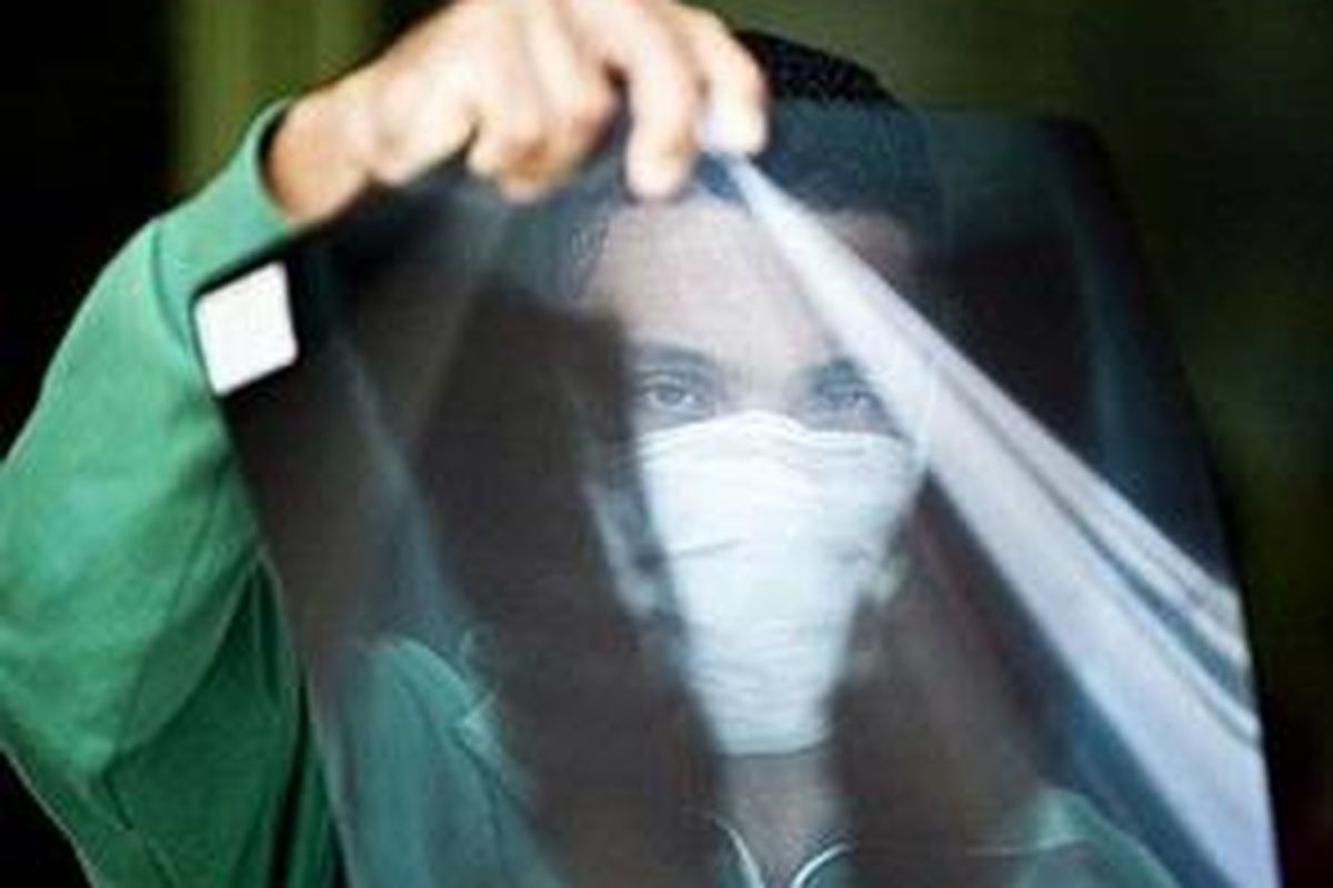 A man holds his lung X-rays after being diagnosed with Influenza A (H1N1) virus, in Rio de Janeiro, in July 2009. The H1N1 virus that causes swine flu is not likely to mutate this season into a 