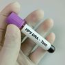 Kenali HPV yang Diduga Jadi Penyebab Naiknya Kasus Kanker di Kalangan Anak Muda India