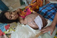 Diserang Kanker Ganas, Nurul Terpaksa Putus Sekolah