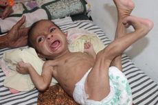 Ditinggal Ibu Merantau, Bayi 8 Bulan Hanya Berbobot 4 Kg