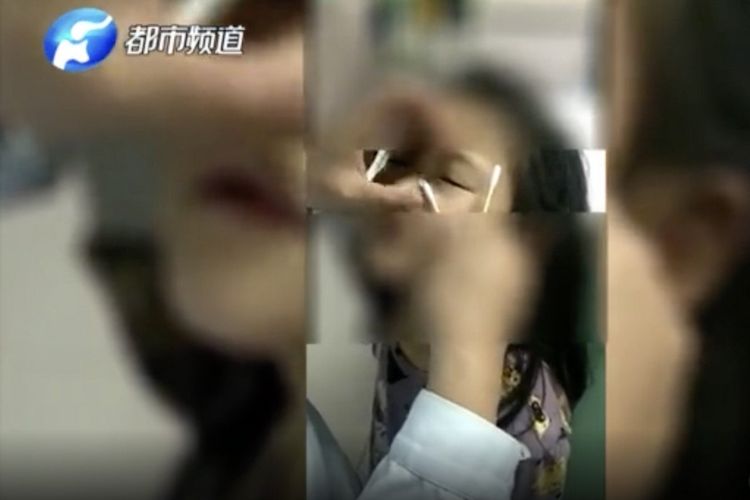 Dokter mengeluarkan potongan kertas dari mata gadis tujuh tahun di Henan, China. Kertas itu dimasukkan oleh tiga anak laki-laki September lalu.