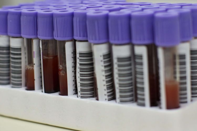 Sampel darah untuk diuji di laboratorium Unit Donor Darah Pusat PMI, Jakarta Selatan, Rabu (14/7/2021). Stok plasma konvalesen sangat minim disebabkan minimnya jumlah penyitas Covid-19 yang mendonorkan plasma.