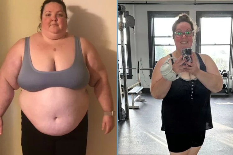 Amanda Lipstate sebelum diet (kiri) dan setelah menjalani diet karnivora (kanan).