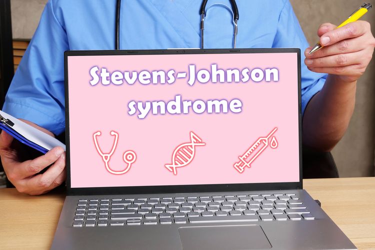 Sindrom Stevens Johnson adalah penyakit langka yang menyebabkan kulit Anda mengalami ruam, melepuh, dan kemudian mengelupas. 