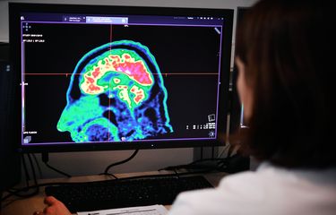 Gambar otak manusia yang diambil oleh pemindaian positron emisi tomografi, juga disebut pemindaian PET, terlihat di layar pada 9 Januari 2019, di Pusat Rumah Sakit Regional dan Universitas Brest (CRHU - Pusat Hospitalier R&eacute;gional et Universitaire de Brest) , Perancis barat. CHRU dari Brest baru saja mengakuisisi alat pencitraan molekuler baru, yang paling canggih di Perancis saat ini menurut pusat rumah sakit, yang mampu mendeteksi lesi yang dalam dan terutama patologi kanker, kata rumah sakit itu pada 9 Januari 2019.
