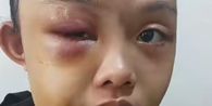 Kisah Gadis Yatim Piatu di Kampar Riau Dianiaya Tante, Tidur di Gudang dan Tak Diberi Makan