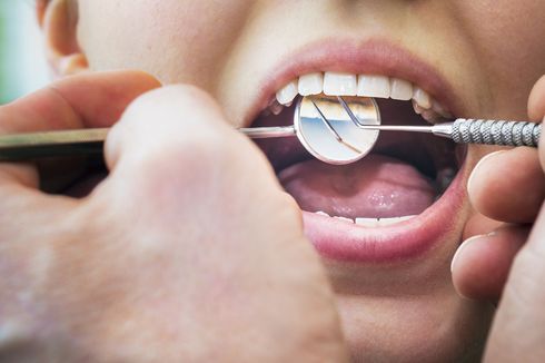 4 Cara Mengatasi Gigi Berlubang secara Medis