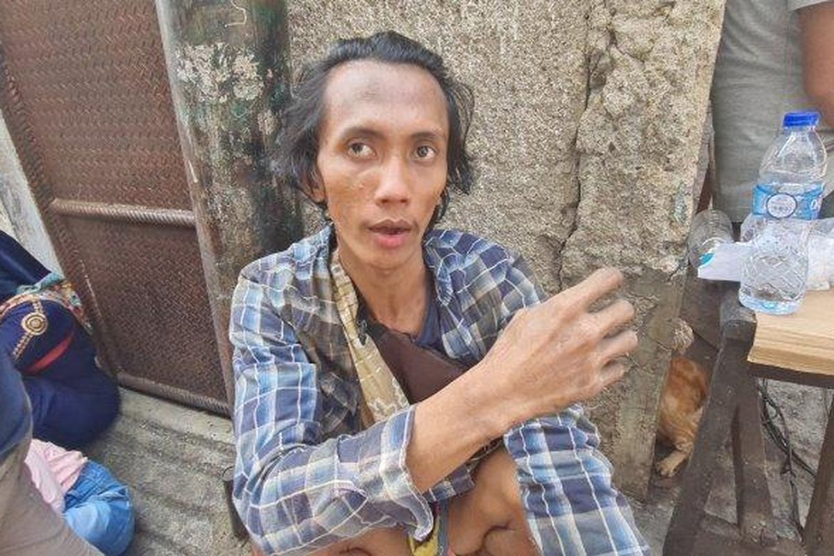 Pengamen topeng monyet, Ardiansyah (28), korban kebakaran di Tambora, RT 005 RW 008 Jakarta Barat pada Selasa (26/7/2022). 
