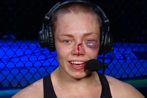 UFC 251, Cedera Mata dan Hidung Mengerikan Rose Namajunas