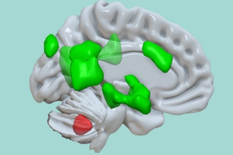 Fungsi otak kecil terungkap dalam sebuah studi. Otak kecil atau Cerebellum (berwarna merah) terhubung dengan berbagai area otak besar (berwarna hijau) untuk meningkatkan penyimpanan informasi emosional.
