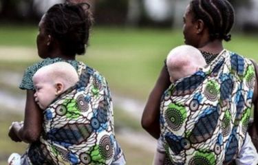 Ilustrasi albino