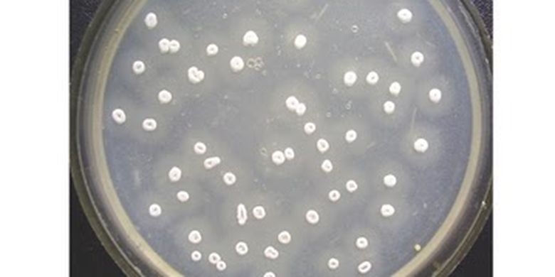 Tetracycline, an antibiotic produced by Streptomyces aureofaciens