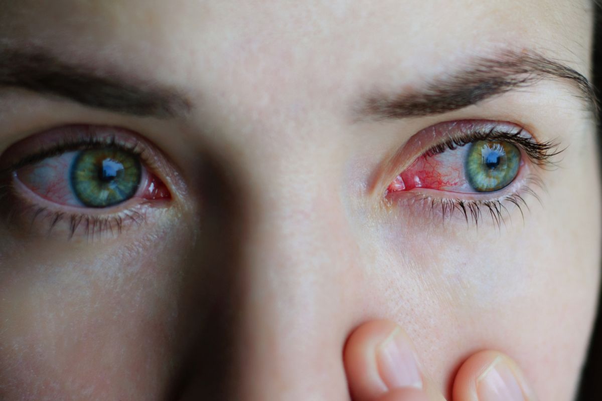 Ilustrasi mata. Siswi di Gresik Buta akibat Dicolok Kakak Kelas, Korban Awalnya Ogah Beri Uang ke Pelaku