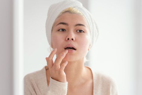 Kenali Penyebab dan Cara Mengatasi Jerawat di Bibir