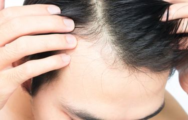 Style Rambut Botak Lelaki 2018 - Cegah Kebotakan Khas Pria dengan 5 Tips Ini Halaman all - Kompas.com