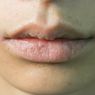 Bibir Pucat