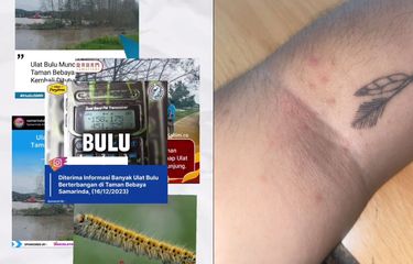 Tangkap layar video ulat bulu di Taman Bebaya Samarinda yang membuat gatal-gatal alergi.