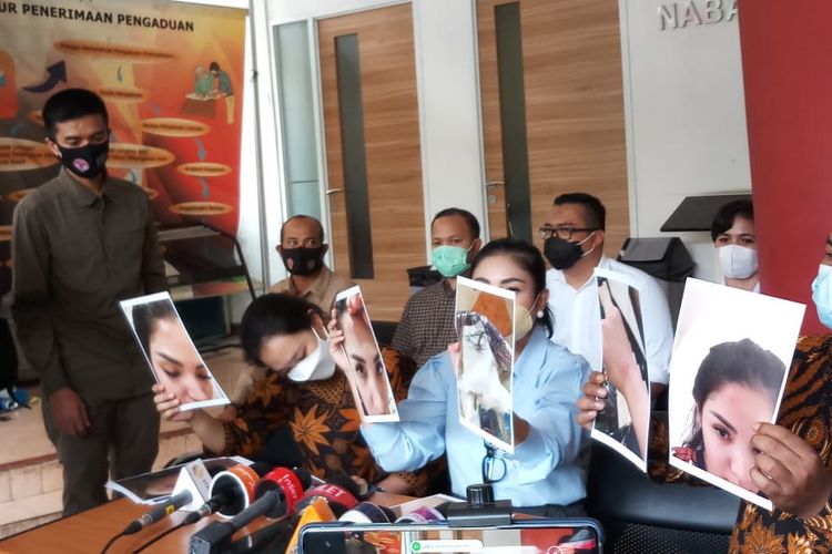 Penyanyi Nindy Ayunda menunjukkan foto-foto lebam pada wajahnya akibat kekerasan dari suaminya, Askara Parasady, di kantor Komnas Perempuan, Jakarta, Selasa (16/2/2021).