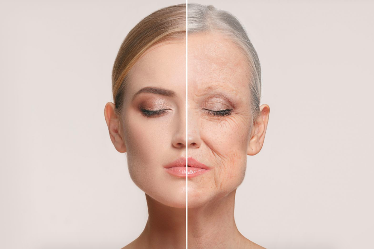 Kondisi kulit wajah yang tampak lebih tua dari usia sebenarnya
