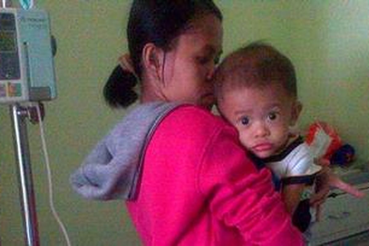 Komariyah sedang menggendong Fathur di RSUD Cengkareng, Jakarta Barat pada Kamis (21/2/2013). Fathur mengalami gizi buruk dengan bobot tubuh 8 kg pada usia 1 tahun.