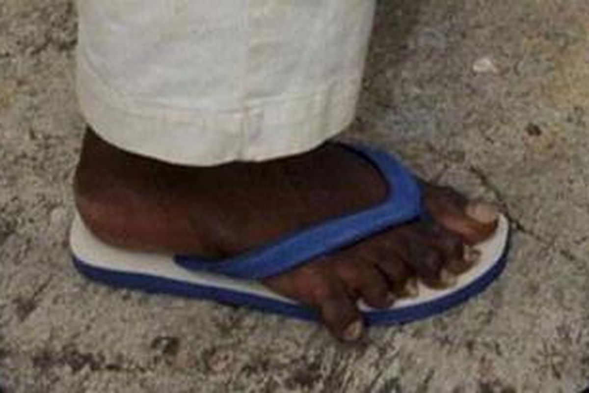 Seorang bajak laut Somalia yang dijuluki Joe Berjari Kaki Enam karena dua kakinya masing-masing berjari enam ditangkap Angkatan Laut Kerajaan Inggris.