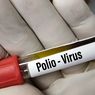 Tanda-tanda Polio dari Berbagai Bentuknya