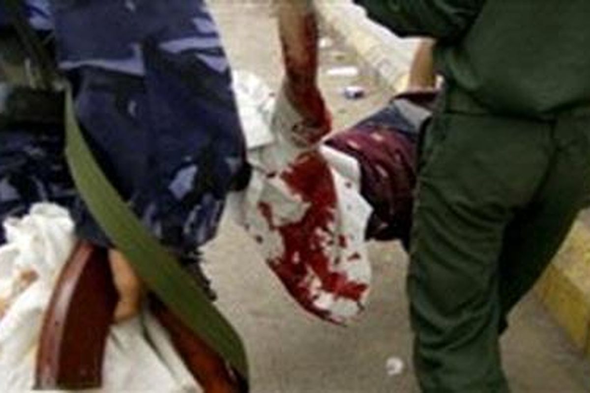 Polisi Yaman membawa korban yang terluka dari bentrokan antara separatis Yaman Selatan dan pasukan keamanan di Kota Houta di Provinsi Lahj, 320 km sebelah selatan Sanaa, pada 13 Februari 2010. 