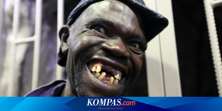 Di Zimbabwe Warga Berebut Jadi Orang Paling Jelek