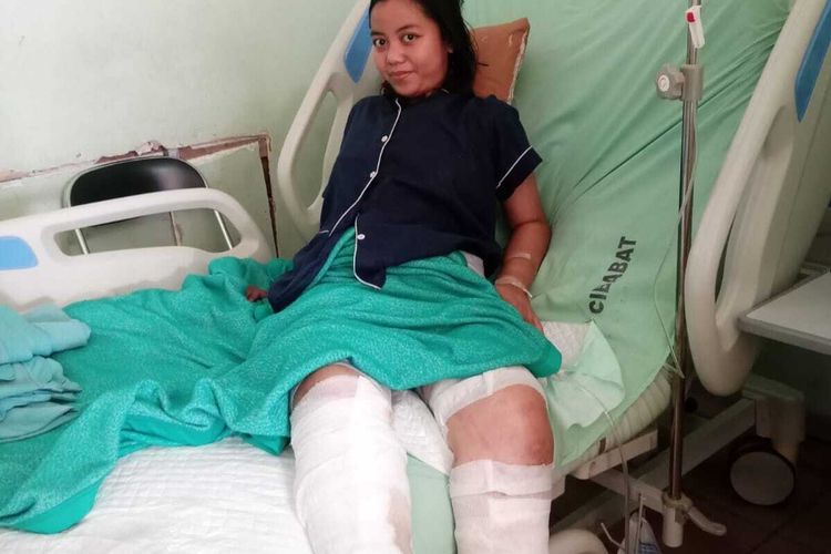 Dinda Monalisa (24) korban tabrak lari di Cimahi yang terlilit biaya pengobatan.