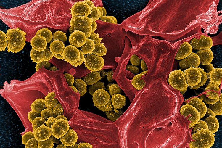 Hasil pemindaian mikrograf elektron dari bakteri Staphylococcus aureus yang resisten atau kebal antibiotik jenis methicillin (kuning) dan sel darah putih manusia yang mati (berwarna merah).