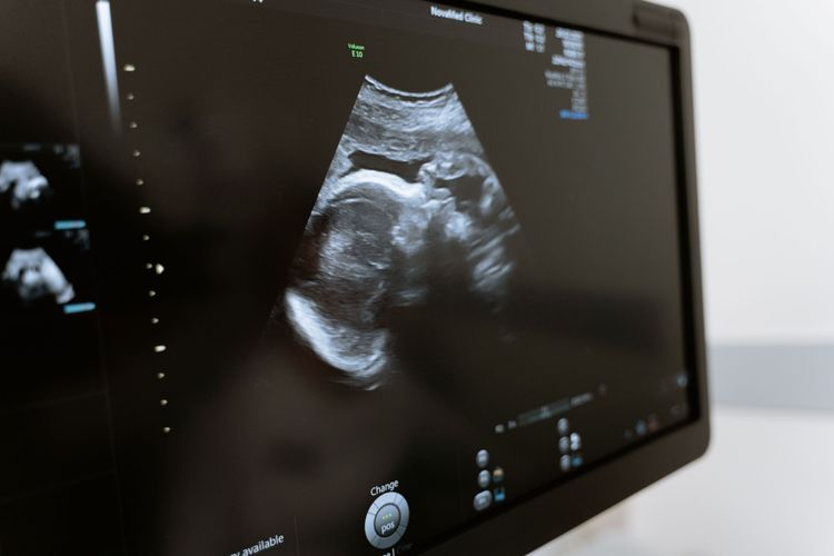 AI Mudahkan Tenaga Kesehatan Skrining Ibu Hamil di Tengah Kekurangan Dokter Spesialis