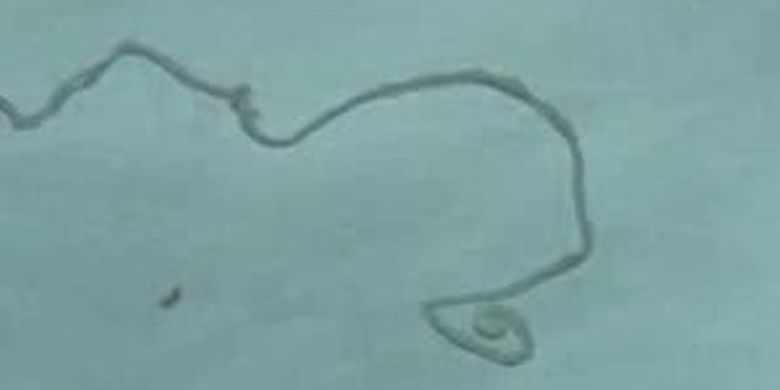 Inilah penampakan cacing pita sepanjang 12 cm yang dilaporkan memakan otak pria di China bernama Wang Lei selama 15 tahun terakhir.