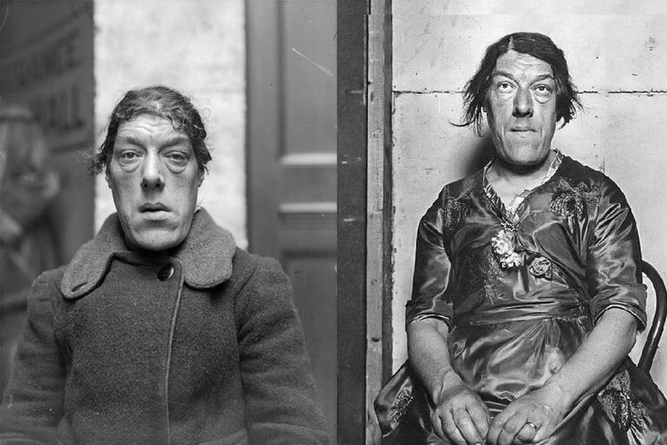 Foto Mary Ann Bevan yang mendapat gelar 'Wanita Terjelek di Dunia' pada 1920.