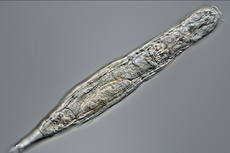 Membeku 24.000 Tahun, Hewan Mikroskopis Ini Mampu Hidup Kembali