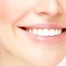Berapa Biaya Veneer Gigi untuk Senyum yang Cantik