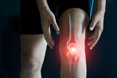 Bagaimana Mengobati Artritis pada Lutut?